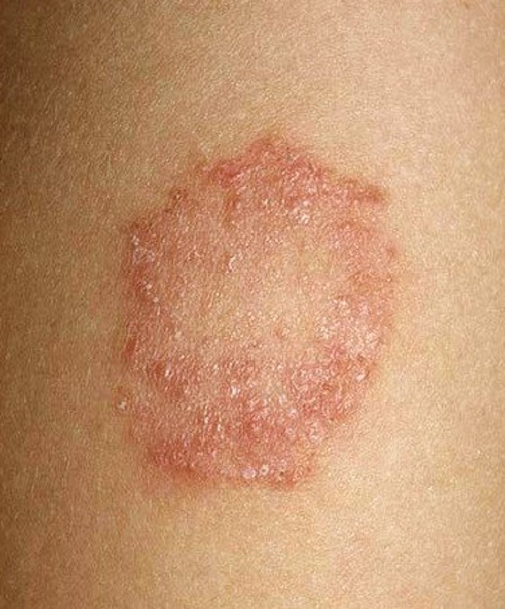 Roundup Ringworm Naturally with Oregano - Camp Wander