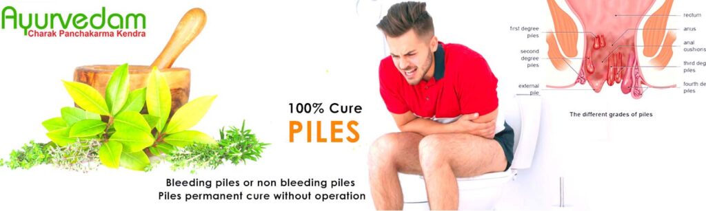 Piles Treatment