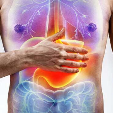 indigestion indigestion Treatment